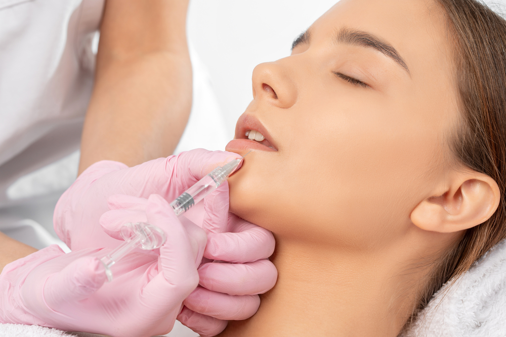 Lippen, Unterspritzung, Ästhetik, Frau, Haare, Spritzen, BioBotox